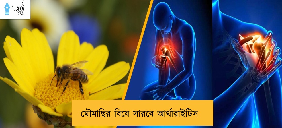 মৌমাছির বিষে সারবে আর্থারাইটিস