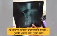 অপারেশন টেবিলে অমনোযোগী ডাক্তার - পেটের ভেতর রয়ে গেলো কাঁচি