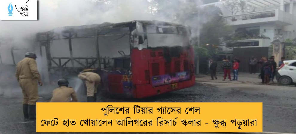 পুলিশের টিয়ার গ্যাসের শেল ফেটে হাত খোয়ালেন আলিগরের রিসার্চ স্কলার - ক্ষুব্ধ পড়ুয়ারা