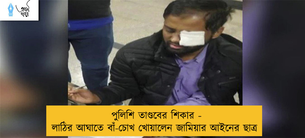 পুলিশি তাণ্ডবের শিকার - লাঠির আঘাতে বাঁ-চোখ খোয়ালেন জামিয়ার আইনের ছাত্র