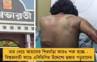 মার খেয়ে আমাদের শিরদাঁড়া আরও শক্ত হচ্ছে - বিশ্বভারতী কাণ্ডে এবিভিপির উদ্দেশ্যে হুঙ্কার পড়ুয়াদের