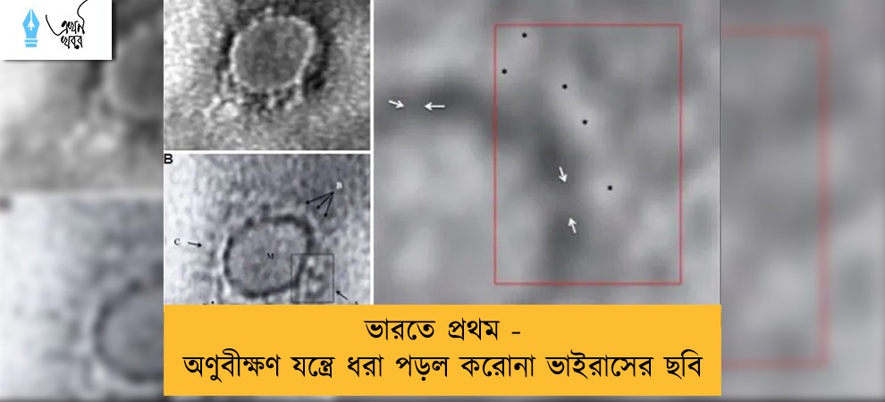 ভারতে প্রথম - অণুবীক্ষণ যন্ত্রে ধরা পড়ল করোনা ভাইরাসের ছবি
