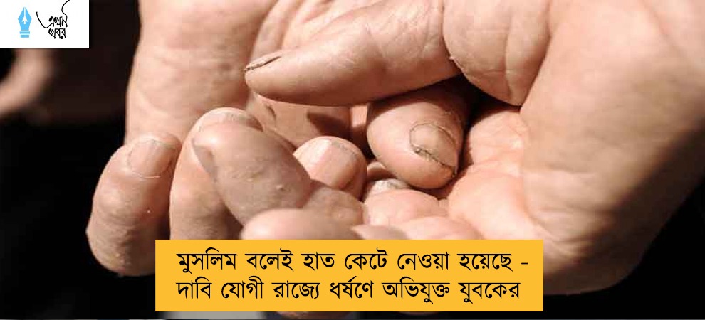 মুসলিম বলেই হাত কেটে নেওয়া হয়েছে - দাবি যোগী রাজ্যে ধর্ষণে অভিযুক্ত যুবকের