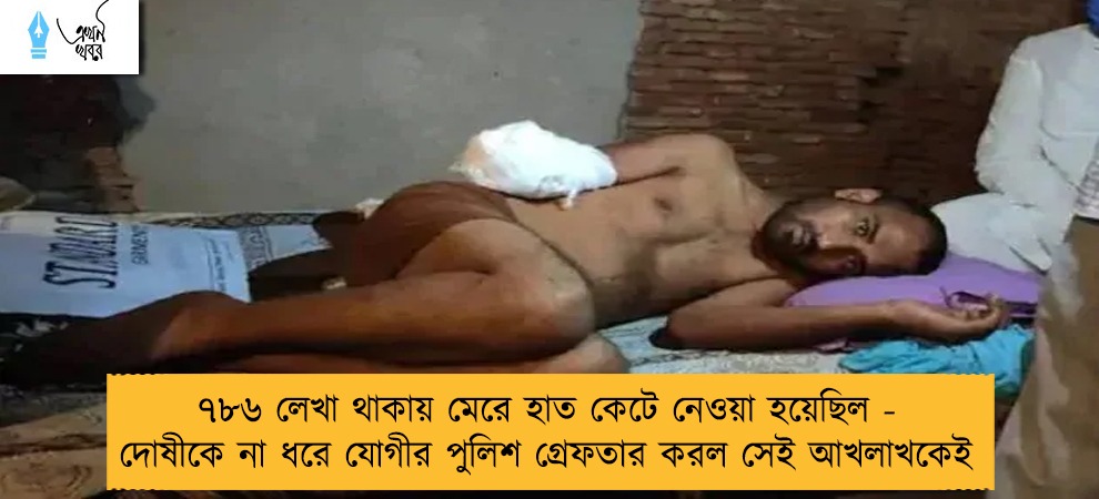 ৭৮৬ লেখা থাকায় মেরে হাত কেটে নেওয়া হয়েছিল - দোষীকে না ধরে যোগীর পুলিশ গ্রেফতার করল সেই আখলাখকেই