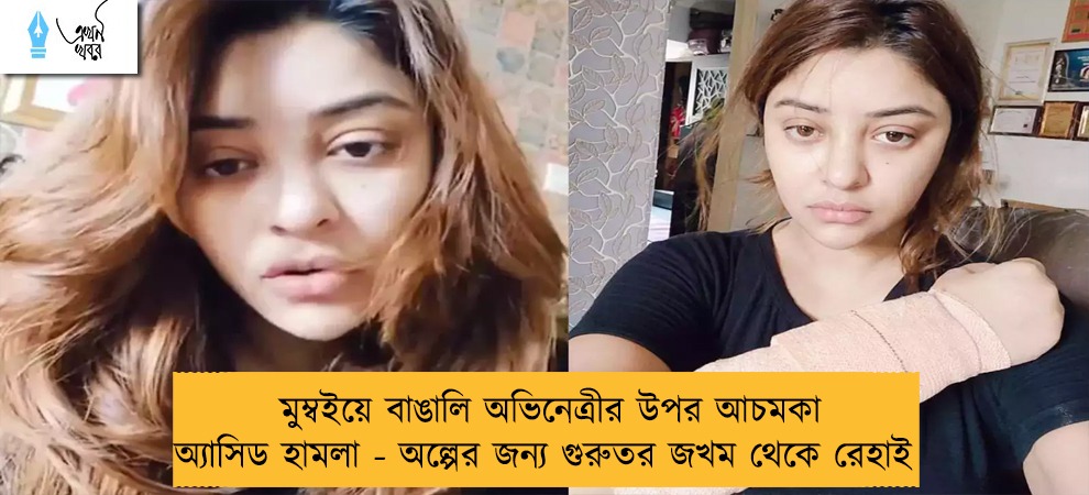 মুম্বইয়ে বাঙালি অভিনেত্রীর উপর আচমকা অ্যাসিড হামলা - অল্পের জন্য গুরুতর জখম থেকে রেহাই    