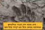 সফল হল জটিল অস্ত্রোপচার - নিজস্ব দক্ষতায় প্রৌঢ়ের লিভার প্রতিস্থাপন করল এসএসকেএম