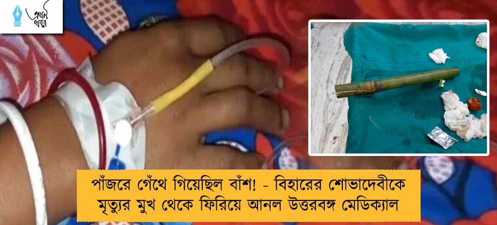 পাঁজরে গেঁথে গিয়েছিল বাঁশ! - বিহারের শোভাদেবীকে মৃত্যুর মুখ থেকে ফিরিয়ে আনল উত্তরবঙ্গ মেডিক্যাল