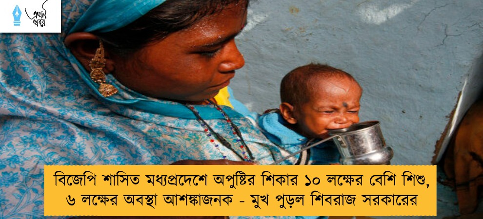 বিজেপি শাসিত মধ্যপ্রদেশে অপুষ্টির শিকার ১০ লক্ষের বেশি শিশু, ৬ লক্ষের অবস্থা আশঙ্কাজনক - মুখ পুড়ল শিবরাজ সরকারের