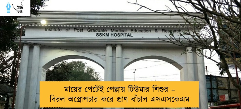 মায়ের পেটেই পেল্লায় টিউমার শিশুর – বিরল অস্ত্রোপচার করে প্রাণ বাঁচাল এসএসকেএম