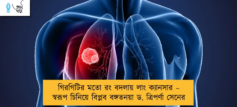 গিরগিটির মতো রং বদলায় লাং ক্যানসার – স্বরূপ চিনিয়ে বিপ্লব বঙ্গতনয়া ড. ত্রিপর্ণা সেনের