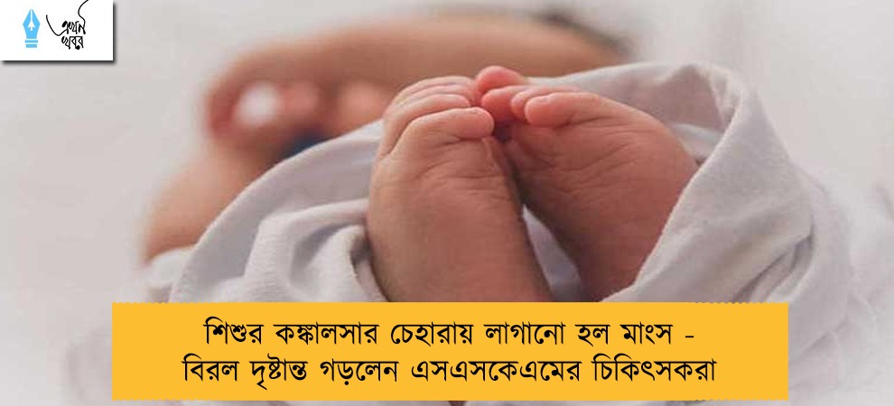 শিশুর কঙ্কালসার চেহারায় লাগানো হল মাংস - বিরল দৃষ্টান্ত গড়লেন এসএসকেএমের চিকিৎসকরা