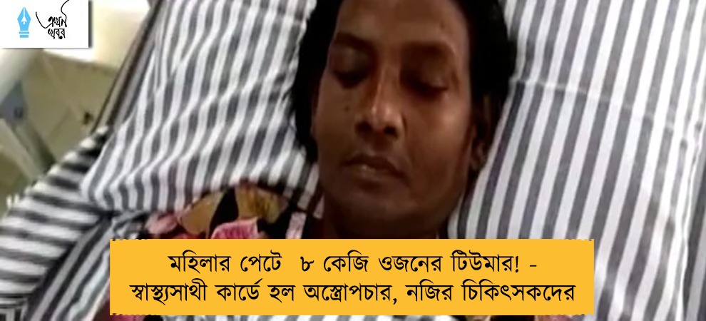 মহিলার পেটে ৮ কেজি ওজনের টিউমার! - স্বাস্থ্যসাথী কার্ডে হল অস্ত্রোপচার, নজির চিকিৎসকদের