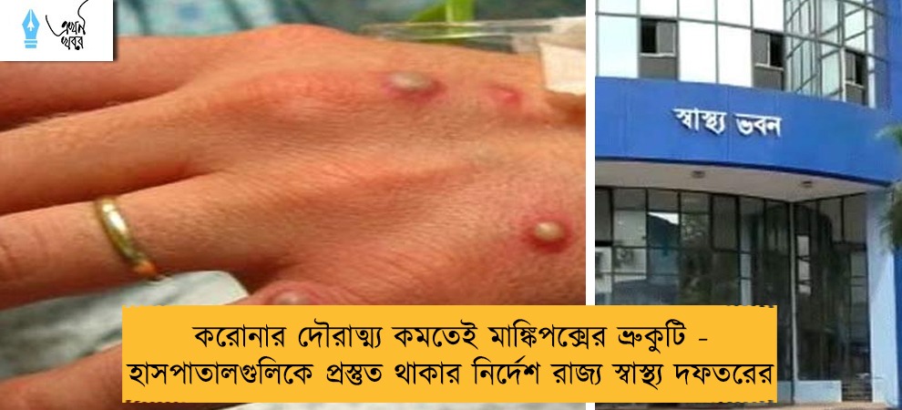 করোনার দৌরাত্ম্য কমতেই মাঙ্কিপক্সের ভ্রুকুটি - হাসপাতালগুলিকে প্রস্তুত থাকার নির্দেশ রাজ্য স্বাস্থ্য দফতরের