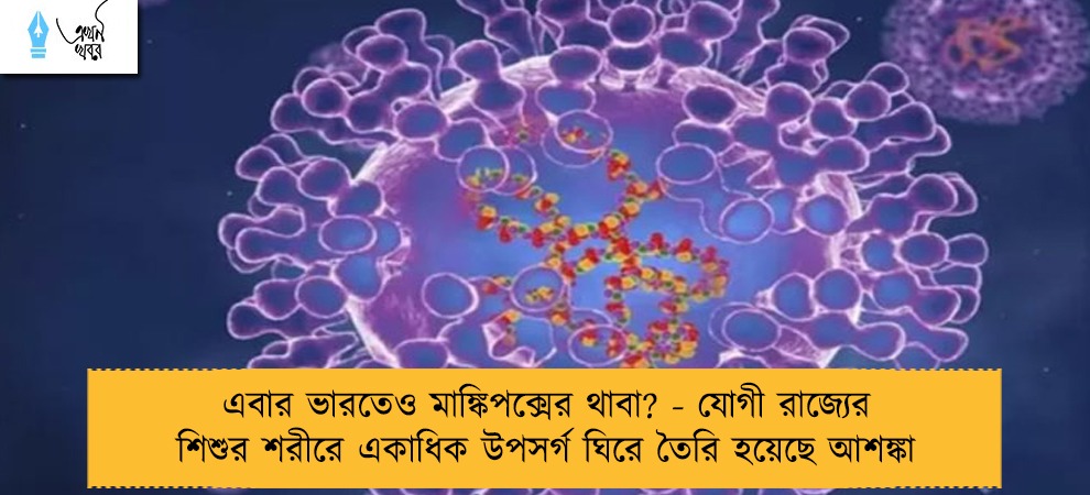 এবার ভারতেও মাঙ্কিপক্সের থাবা? - যোগী রাজ্যের শিশুর শরীরে একাধিক উপসর্গ ঘিরে তৈরি হয়েছে আশঙ্কা