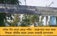 নাভির নীচ থেকে জোড়া শরীর - অস্ত্রোপচার করে যমজ শিশুকে পৃথিবীর আলো দেখাল সরকারী হাসপাতাল