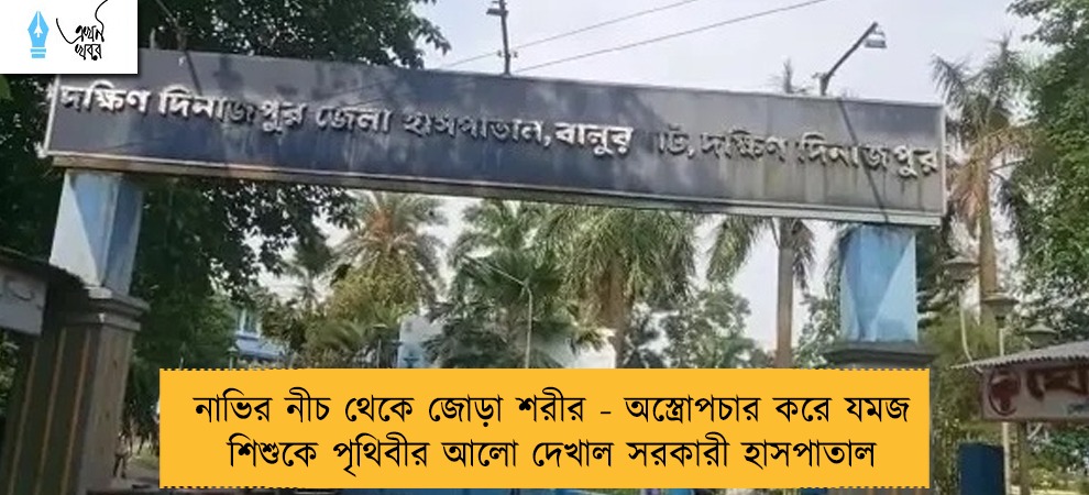 নাভির নীচ থেকে জোড়া শরীর - অস্ত্রোপচার করে যমজ শিশুকে পৃথিবীর আলো দেখাল সরকারী হাসপাতাল