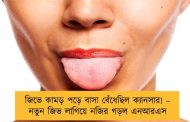 জিভে কামড় পড়ে বাসা বেঁধেছিল ক্যানসার! – নতুন জিভ লাগিয়ে নজির গড়ল এনআরএস