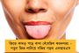 উইম্বলডন ওপেন - একই দিনে বিদায় নিলেন মারে, রাদুকানু
