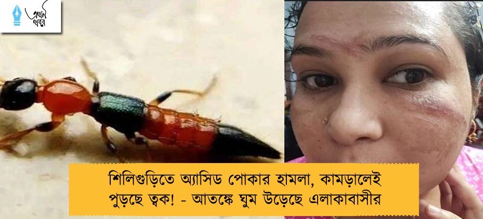 শিলিগুড়িতে অ্যাসিড পোকার হামলা, কামড়ালেই পুড়ছে ত্বক! - আতঙ্কে ঘুম উড়েছে এলাকাবাসীর
