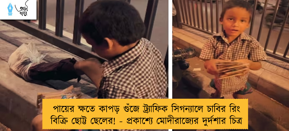 পায়ের ক্ষতে কাপড় গুঁজে ট্র্যাফিক সিগন্যালে চাবির রিং বিক্রি ছোট্ট ছেলের! - প্রকাশ্যে মোদীরাজ্যের দুর্দশার চিত্র