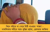খিদে সইতে না পেরে মিষ্টি খাওয়ার ‘সাজা’! - নাবালিকার শরীরে গরম খুন্তির ছ্যাঁকা, গ্রেফতার কাকিমা