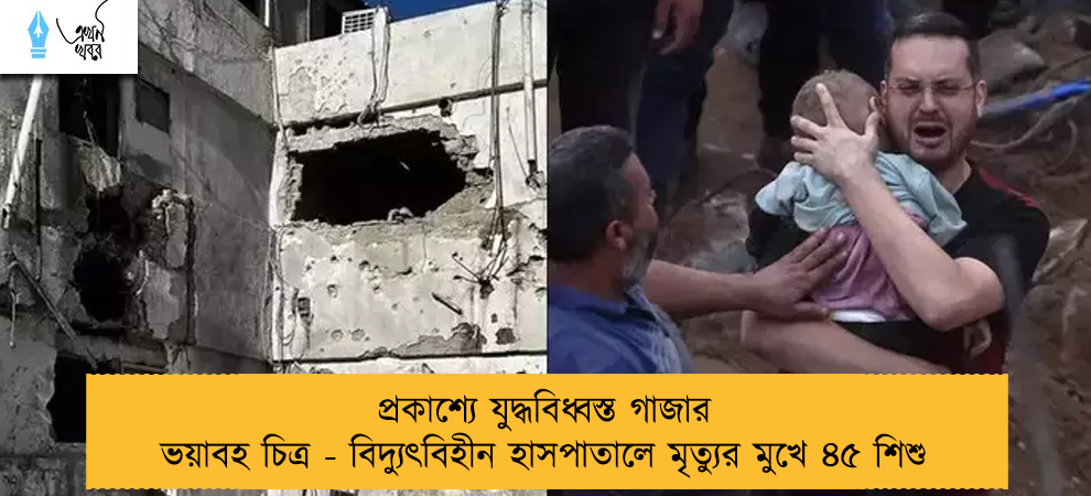 প্রকাশ্যে যুদ্ধবিধ্বস্ত গাজার ভয়াবহ চিত্র - বিদ্যুৎবিহীন হাসপাতালে মৃত্যুর মুখে ৪৫ শিশু